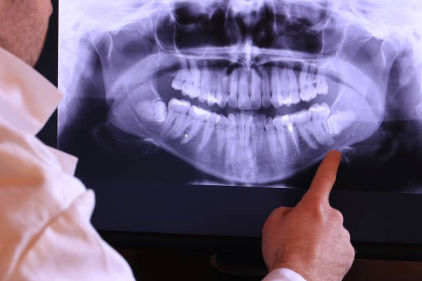 Best Broken or Chipped Tooth Repair in Beverly, OH