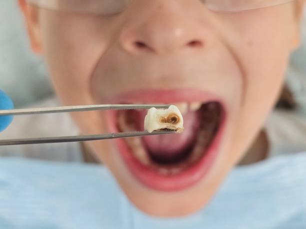 Best Emergency Cosmetic Dentistry (e.g., broken veneers) in Beverly, OH